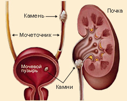 диета японская клиника